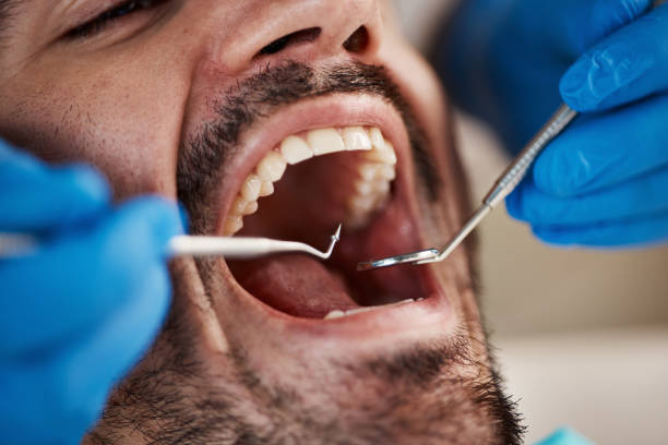 Best Emergency Dentist for Knocked-Out Tooth in Sparta, WI