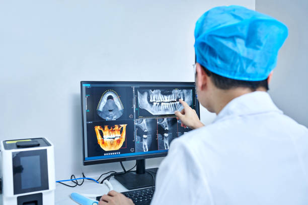 Best Emergency Dentist for Lost Fillings or Crowns in Sparta, WI